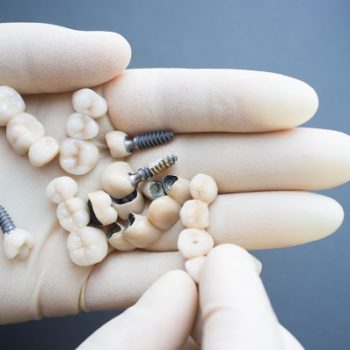 dental implants in a hand