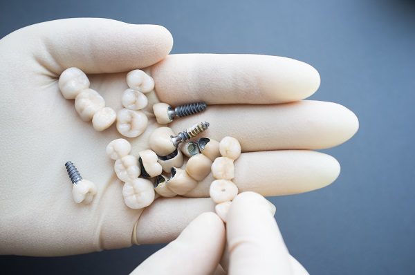 dental implants in a hand