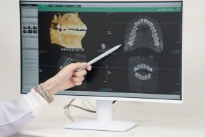 dentist pointing at scan of teeth